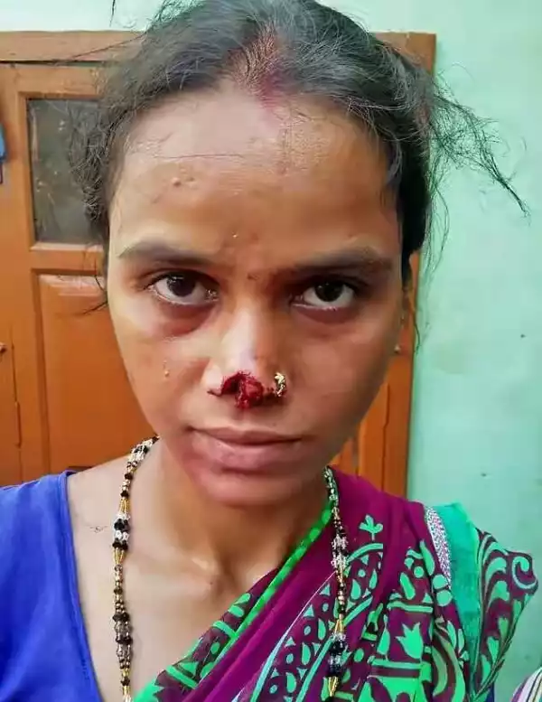 Photo: Indian Husband Cuts Off Wife